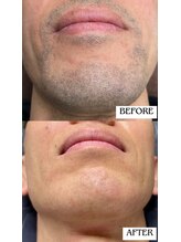 バディーズ(BUDDieS)/40代