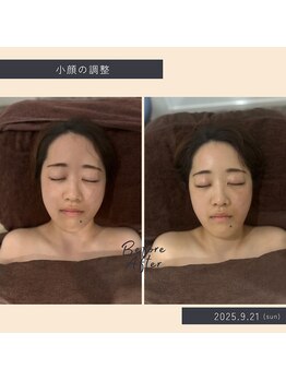 ソロウノ 平和島本院/小顔調整