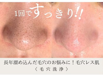 ザ ベルネス(The bellness)