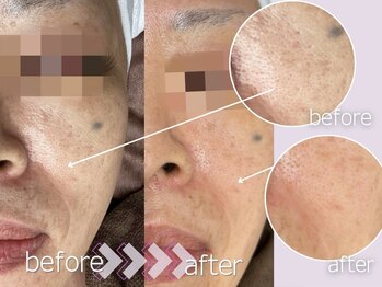 マルサンカクシカク(○△□)/