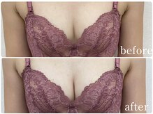 ルナリア ルクス 志木南口駅前店/デコルテ下のハリぷるふわバスト