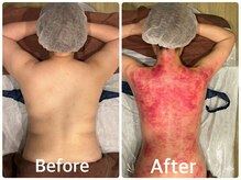 グラン ソレイユ(GRAN SOLEIL)の雰囲気（背中、全身贅肉脂肪を落として、見た目を別人級を叶える◎）