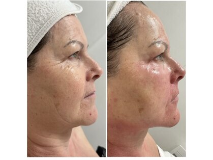 ティーボックスボーテ(TBOX beaute)の写真