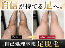 ツバキ(TSUBAKI)