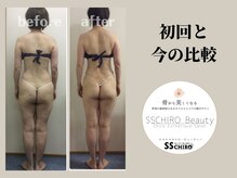 エスエスカイロビューティー(SSCHIRO beauty)/美骨ボディ1部位〔美脚〕過去今