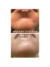 シャムリー 並木坂(Syamry)/肌悩み改善ハーブ