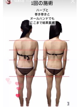 ビューティーチャージ(BeautyCharge)/beforeafter 40代