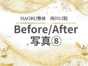 ナオル整体 西川口院(NAORU整体)/西川口 蕨 戸田 整体 骨盤矯正