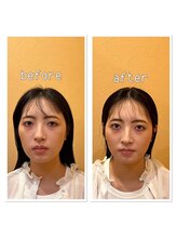 青葉台駅前結び整体院/『驚きの効果』美容小顔整体