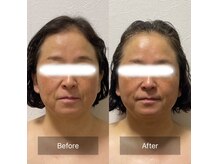 ヒール(heal)の雰囲気（コルギは骨格美容！小顔効果有り。透明感あるモチモチ肌へ）