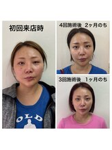 トータルバランス整体院 &nbsp;オレンジ(ORANGE)/小顔矯正モニター/梅田小顔/整体