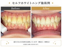 ピュアホワイトニング 横浜店