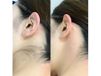 エスポワール ビューティ(Espoir beaute)の写真