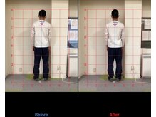 けいのき鍼灸整骨院/姿勢から身体を楽に!整体/肩こり