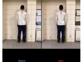 けいのき鍼灸整骨院/姿勢から身体を楽に!整体/肩こり