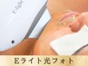 【圧倒的ハリ艶★Eライト光フォト】もたつくフェイスラインも撃退！ ¥9900