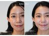 【トーンアップ肌♪全顔ワックス付】美眉スタイリング