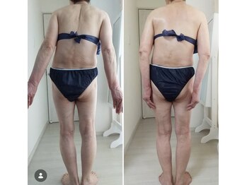 エメ(Aimer)/【70代リバイセルボディ結果☆】