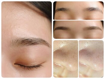 トータルビューティ ノイド(Noid)/小鼻コース+美眉毛WAX脱毛