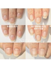 ニコプラス(NICO+)/自爪育成パラジェルクリア補強