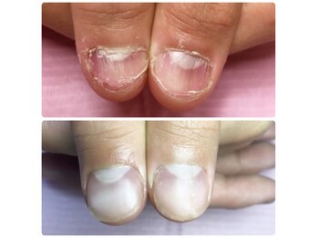 ポミグラニットフィンガーズ(Pomegranate Fingers)