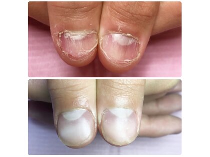 ポミグラニットフィンガーズ(Pomegranate Fingers)の写真