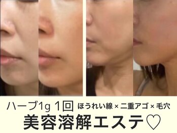 ビープランニング(B-PLANNING.)/【ENMA】たるみにアプローチ★