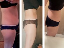 ヨサパーク ナナラーレア 福島店(YOSA PARK nanala lea)/痩身/ダイエット/よもぎ蒸/水素