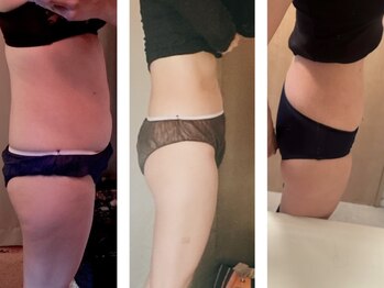 ヨサパーク ナナラーレア 福島店(YOSA PARK nanala lea)/痩身/ダイエット/よもぎ蒸/水素