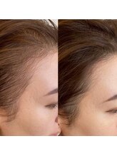 グラーティア(gratia)/プロセル育毛促進トリートメント