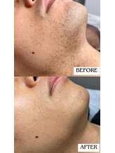 バディーズ(BUDDieS)/30代