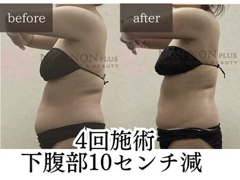 ノンノンプラス 博多(NON-NONプラス)