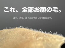 エンブロウスキン 札幌(en BROW & SKIN)の雰囲気(【フェイスワックス】肌トラブルがあるなら、まずは脱毛を!)