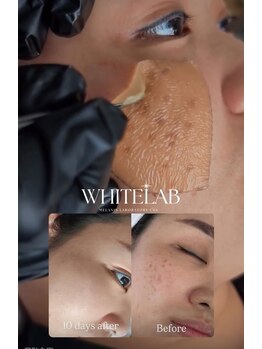 さくら整体院の写真/韓国最新シミケア　WHITE LAB ”ついに苫小牧に上陸”