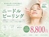 【フェイシャル】ハーブを超えるスピキュールニードルピーリング/ニキビ改善