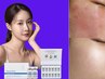 韓国最新ピーリング☆白玉肌へ【ダクトピール】プラズマミスト付き¥12000→