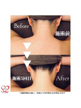 オリオンドットエスツー(Orion.S2)/【Before→After】