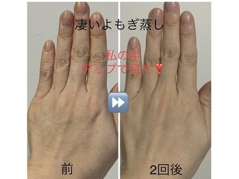 エメ 心斎橋(Aimer)/結果重視のよもぎ蒸しスタート