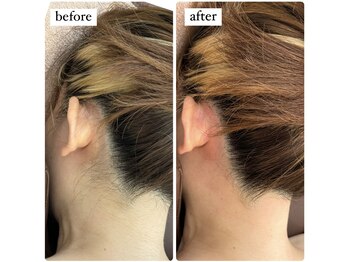 エースマイルイズ(A smile is..)/うなじワックス