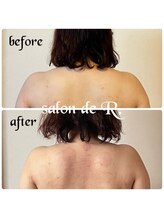 サロン ド アール(salon de R.)/【お背中骨氣・30代・施術効果】