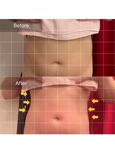 エモーション 町田店(E-Motion)/腰周り/ポッコリお腹のお悩みに