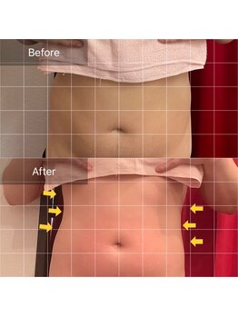 エモーション 町田店(E-Motion)/腰周り/ポッコリお腹のお悩みに