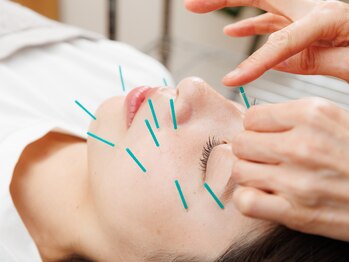 グリーンルーム鍼灸治療院/美容鍼