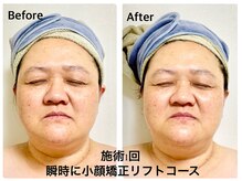 マリア(MALIA)/#南森町小顔#たるみ#筋膜