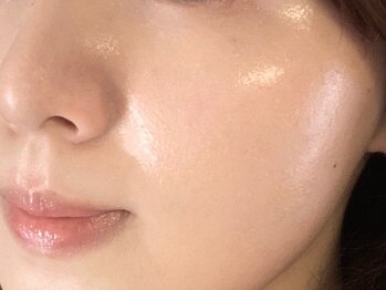 フォルトゥーナ(fortuna)の写真/韓国発の集中ケアで、ほうれい線やたるみを改善◎理想のつるつる素肌を目指しましょう♪