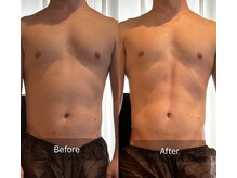 アリッチ 岡崎店(a.Rich)/たった１回で引き締まったお腹に