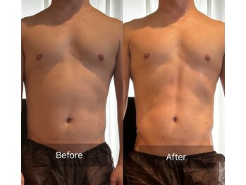 アリッチ 岡崎店(a.Rich)/たった1回で引き締まったお腹に