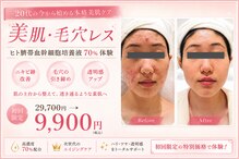 イーズ ミュゼ &nbsp;ららぽーと横浜店