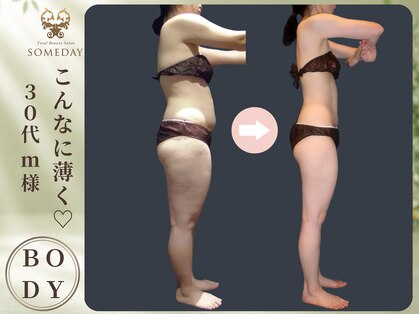 トータルビューティーサロン サムデイ(SOMEDAY)の写真