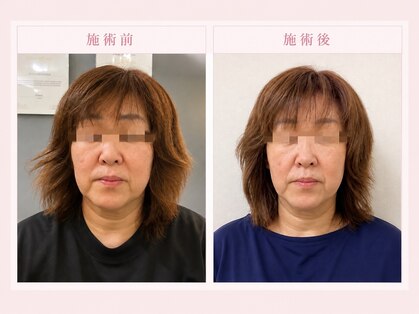 小顔美肌ファクトリー 金沢院の写真
